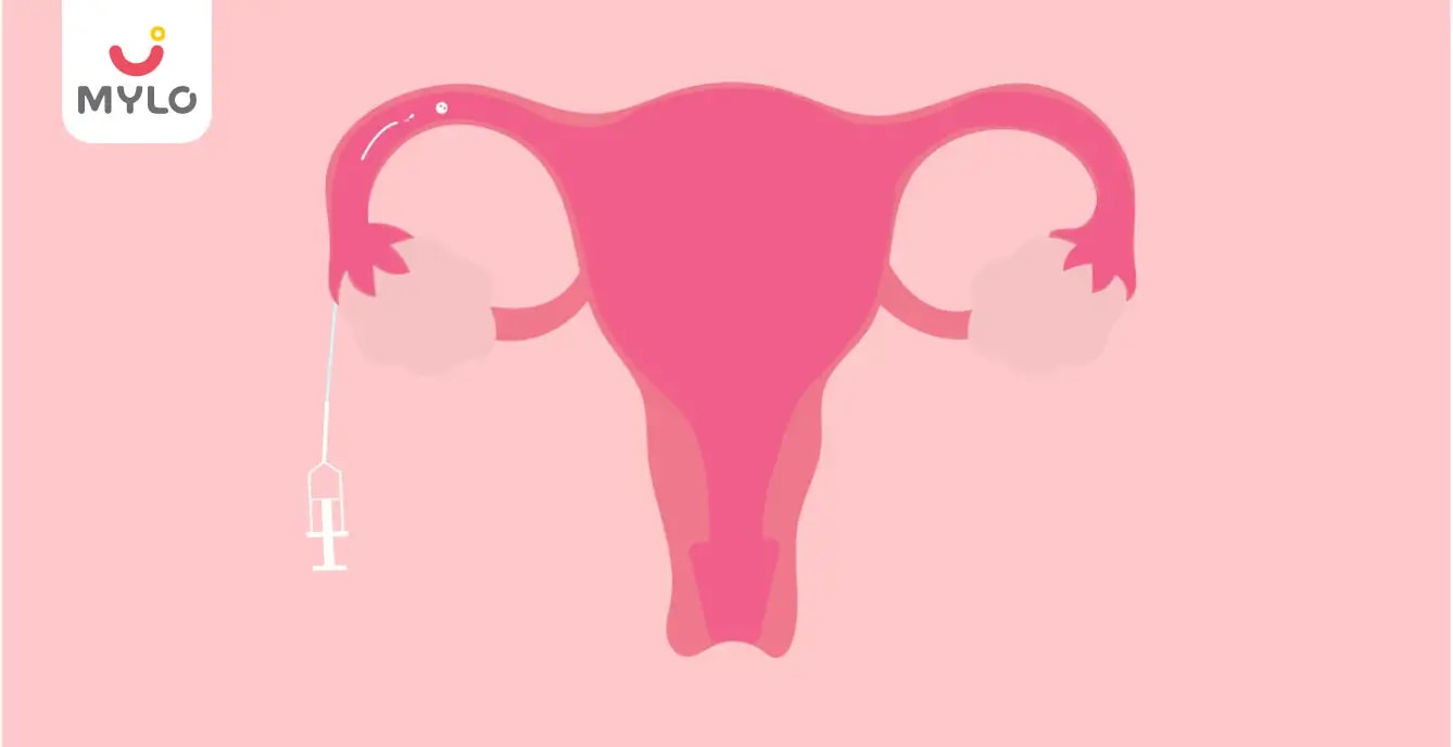 Endometrial Scratching Meaning, Benefits and Impact on Conception MyloFamily