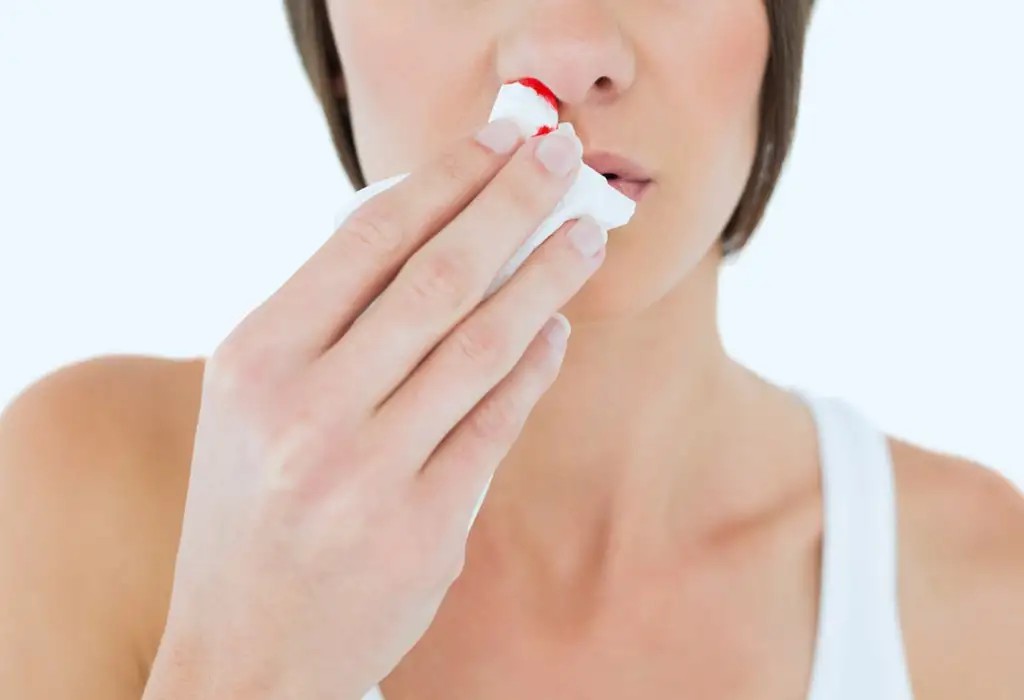 nose-bleeding-during-pregnancy