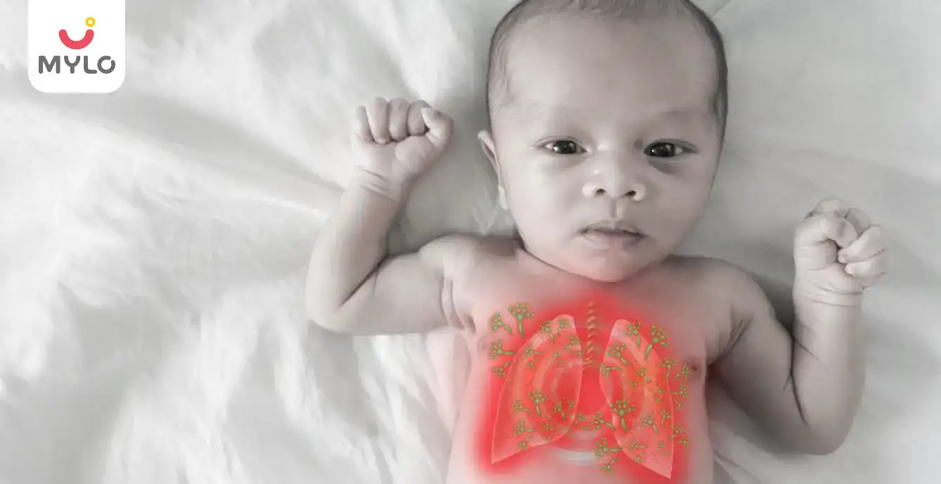 Meconium Aspiration Syndrome Symptoms, Causes & Treatment MyloFamily