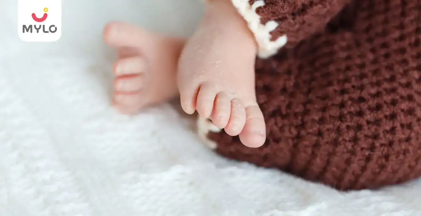 Newborn’s Skin Peeling Causes & Treatment MyloFamily