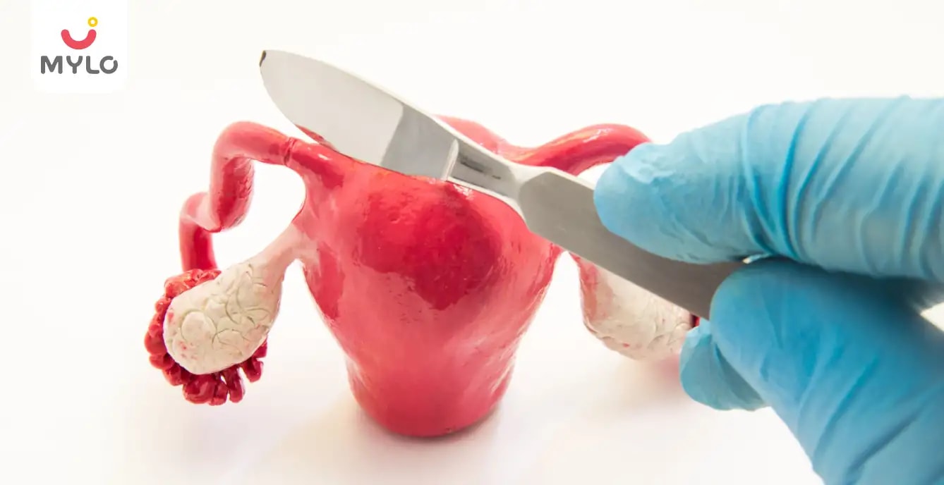 Tubal Recanalization How This Procedure Can help Restore Your Fertility MyloFamily