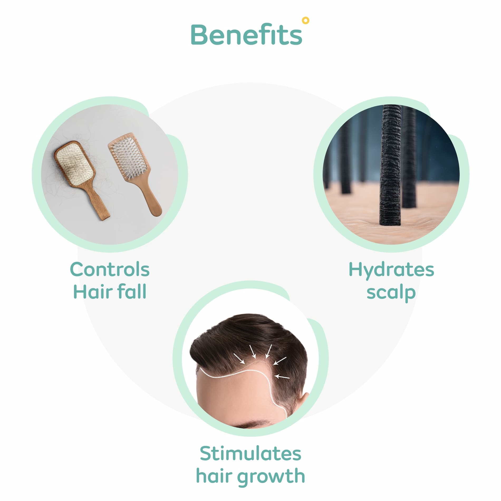 Mylo Onion Hair Growth Revival Kit - Shampoo (200 ml) & Conditioner (200 ml)