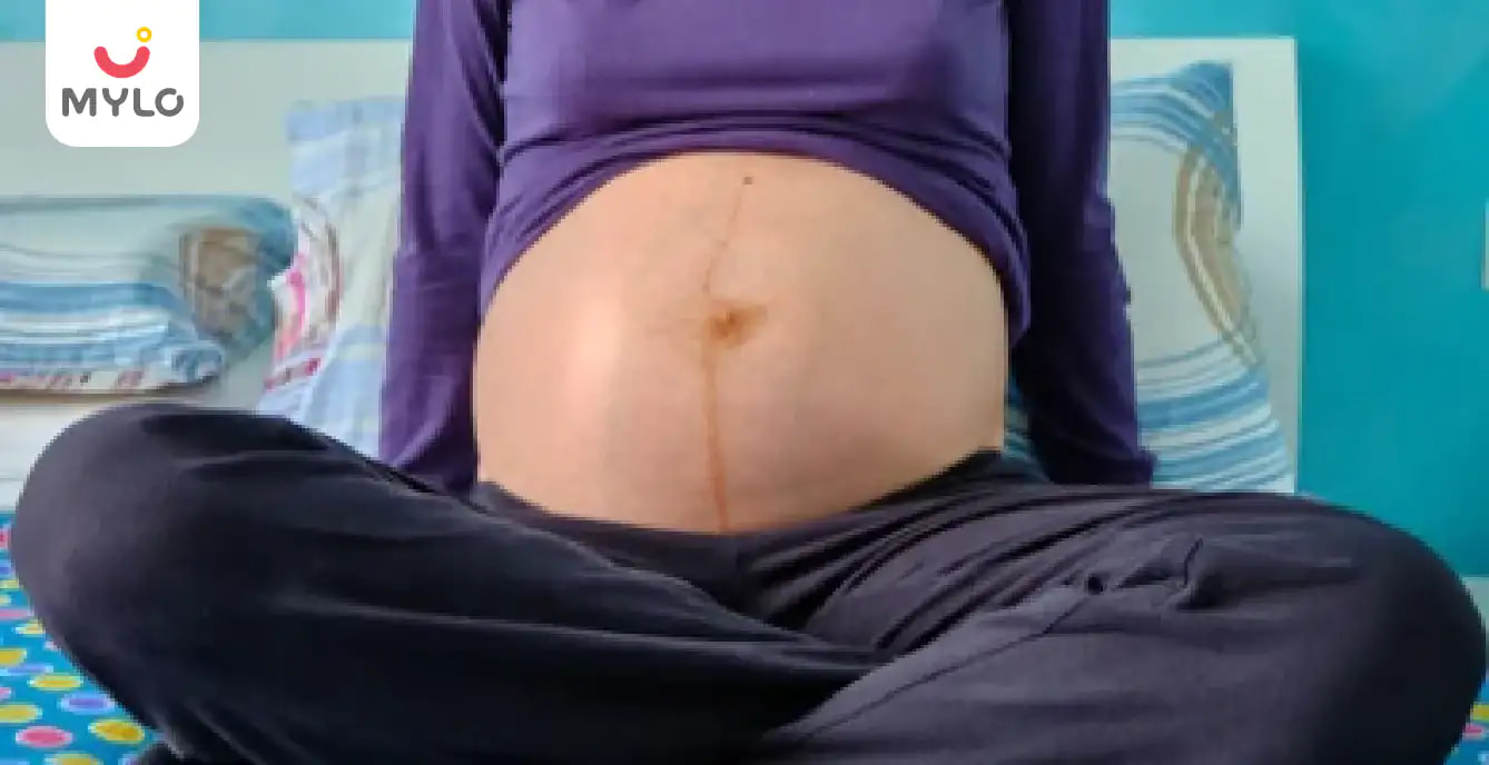 What Does That Line on Your Pregnant Belly Mean and Why It Appears