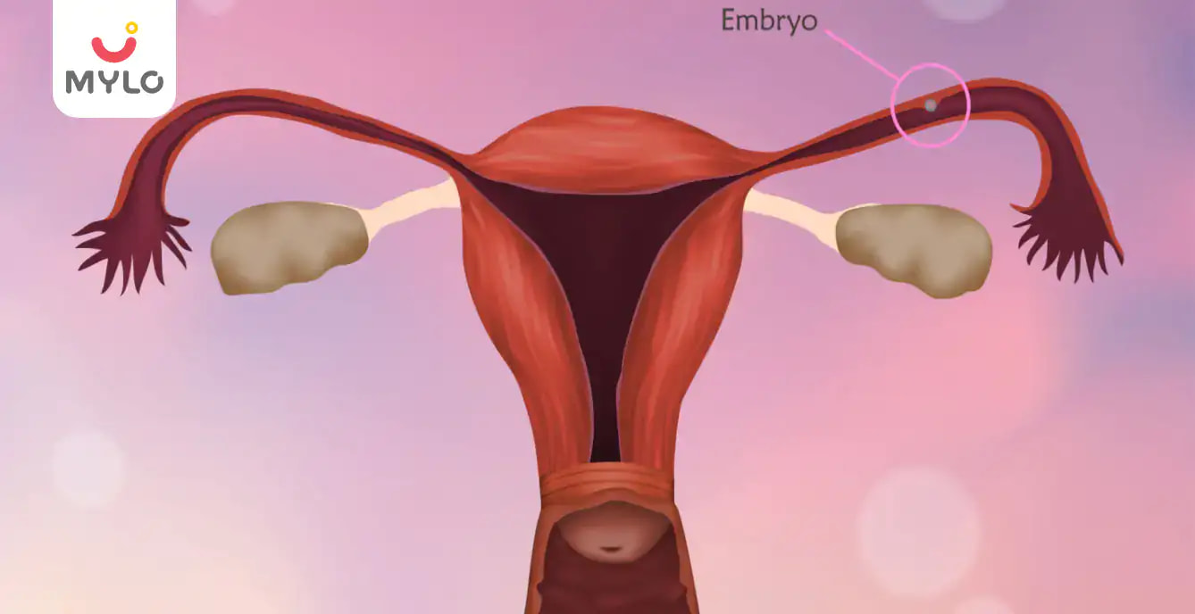 When Do Ectopic Pregnancy Symptoms Start?