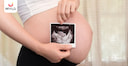Images related to How Important is an Ultrasound During Your Fourth Week of Pregnancy? 