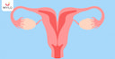Images related to Bicornuate Uterus: Meaning, Symptoms & Risks
