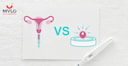 Images related to Difference Between IUI and IVF: Which is Better for You?