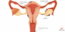 Images related to How to Differentiate Between Implantation Bleeding and Your Periods? 