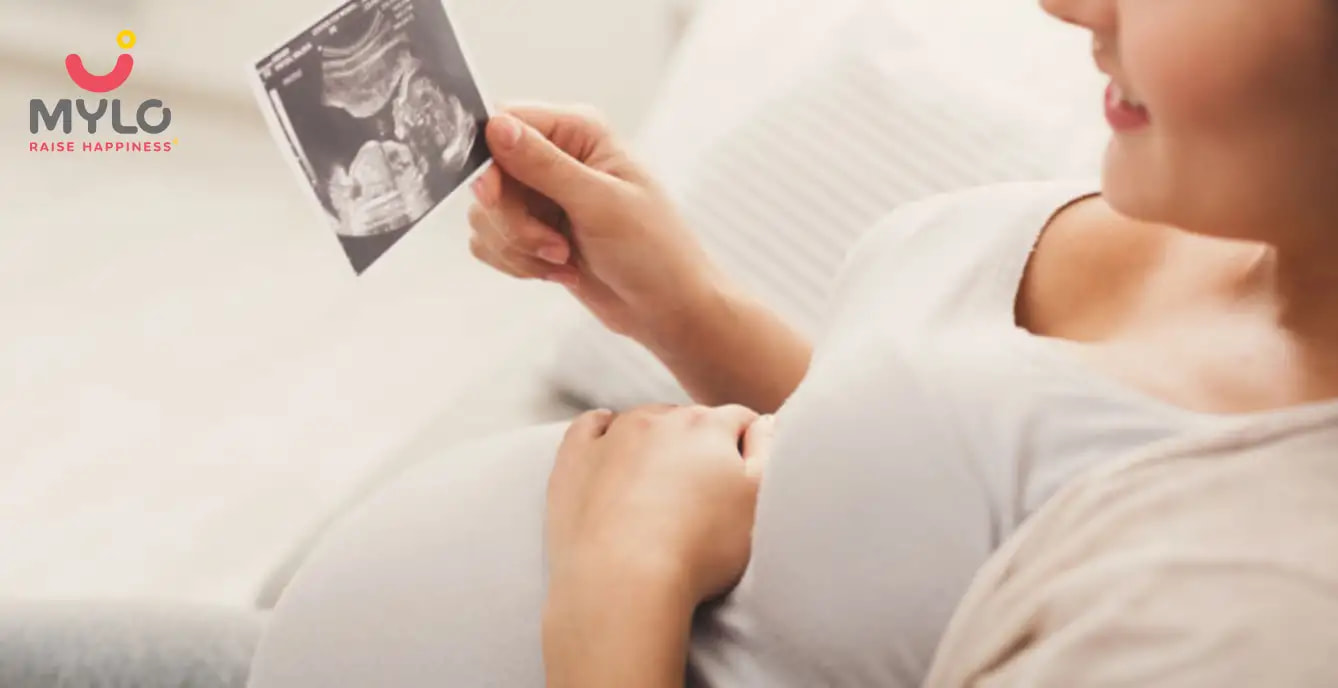 Posterior Placenta: A Comprehensive Guide for Moms-to-Be