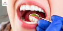 Images related to दाँतों का ख़्याल रखने के लिए ज़रूरी हैं ये बातें! 
