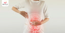 Images related to Irritable Bowel Syndrome : Meaning, Causes, Types & Treatment
