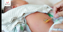 Images related to Umbilical Cord: Risks, Benefits & Recovery