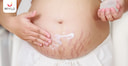 Images related to How to Get Rid of Red Stretch Marks that occur during pregnancy?	