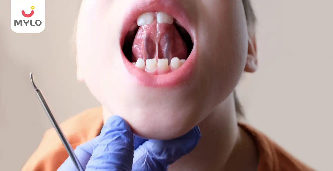Tongue Tie: Meaning, Symptoms & Causes 
